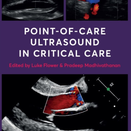 Point-of-Care Ultrasound in Critical Care