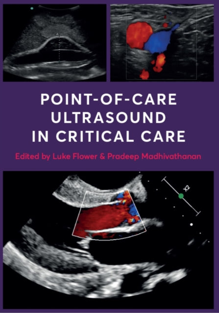 Point-of-Care Ultrasound in Critical Care