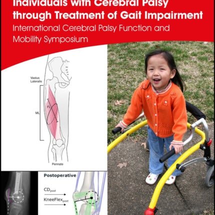 Improving Quality of Life for Individuals with Cerebral Palsy through Treatment of Gait Impairment: International Cerebral Palsy Function and Mobility