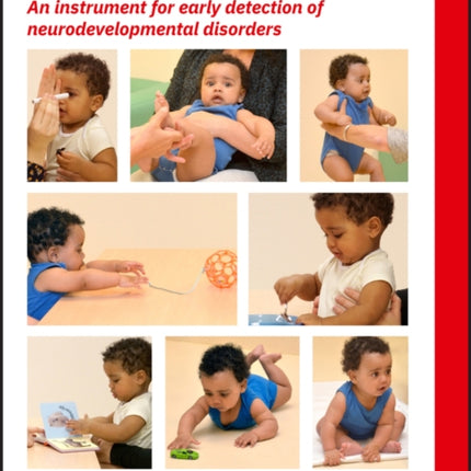 SINDA Standardized Infant NeuroDevelopmental Assessment: An Instrument for Early Detection of Neurodevelopmental Disorders