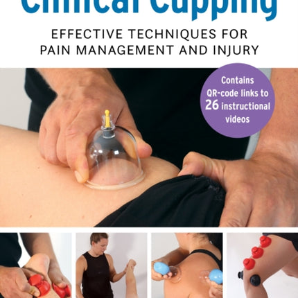 A Practitioner's Guide to Clinical Cupping: Effective Techniques for Pain Management and Injury