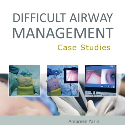 Difficult Airway Management: Case Studies