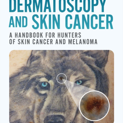 Dermatoscopy and Skin Cancer second edition