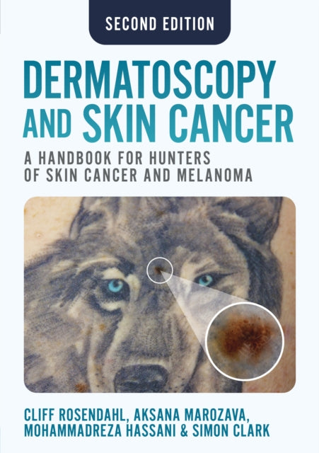 Dermatoscopy and Skin Cancer second edition