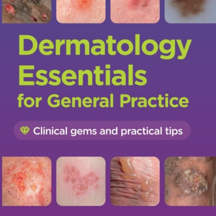 Dermatology Essentials for General Practice