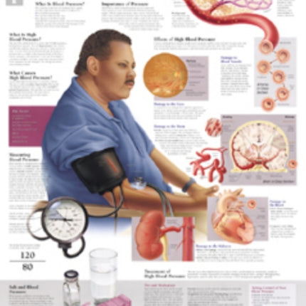 High Blood Pressure Laminated Poster