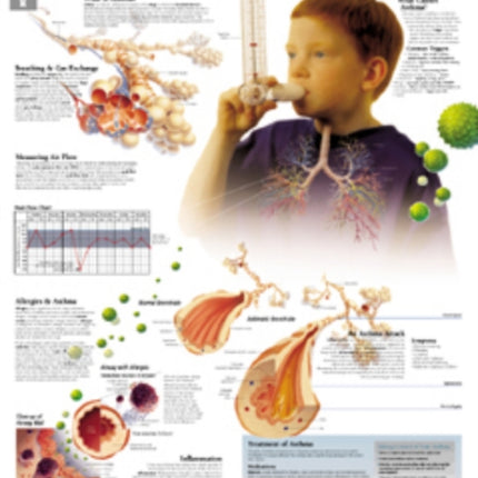 Understanding Asthma Paper Poster