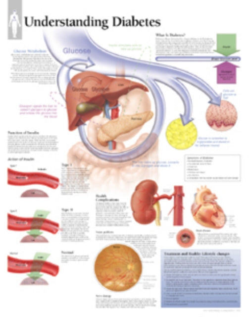 Understanding Diabetes Paper Poster