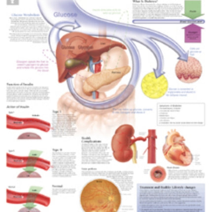 Understanding Diabetes Laminated Poster