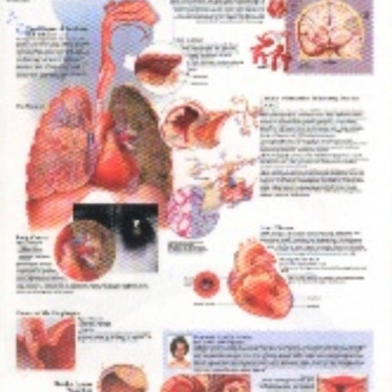 Effects of Smoking Paper Poster