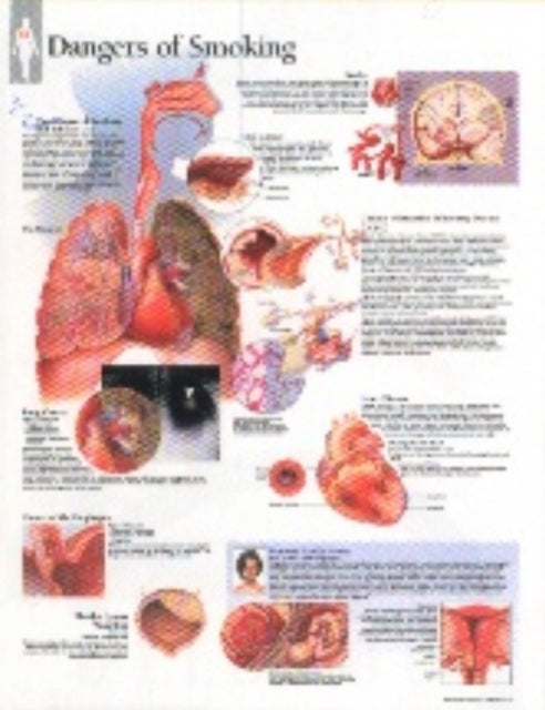 Effects of Smoking Laminated Poster