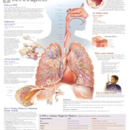 COPD & Asthma Paper Poster