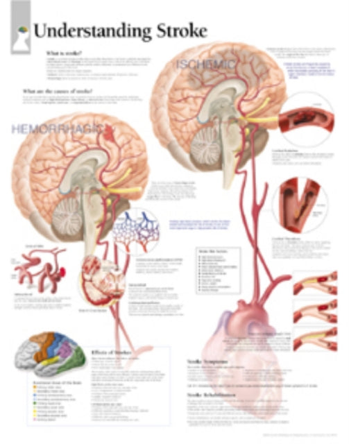 Understanding Stroke Paper Poster