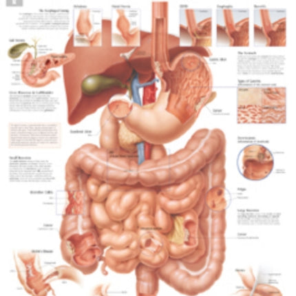 Diseases of the Digestive System Laminated Poster