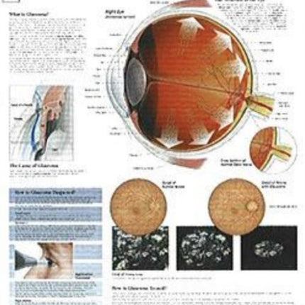 Understanding Menopause Paper Poster