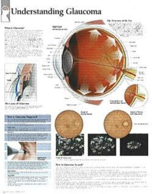 Understanding Menopause Paper Poster