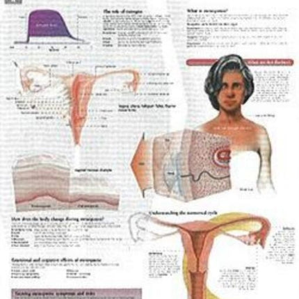 Understanding Menopause Laminated Poster