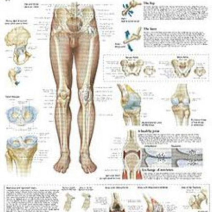 Understanding the Hip & Knee Laminated Poster