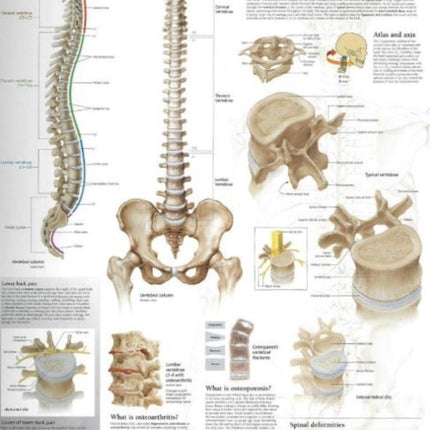 Understanding the Spine Paper Poster