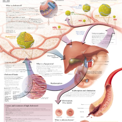 Understanding Cholesterol Paper Poster