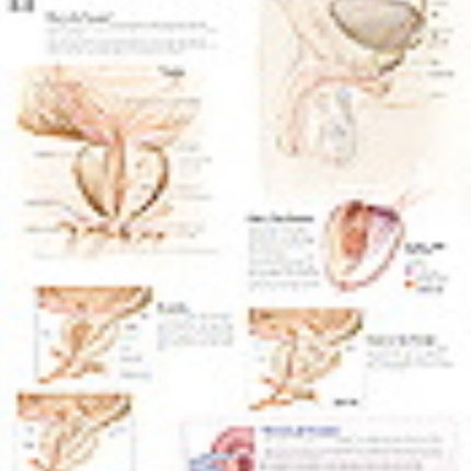 Understanding the Prostate Paper Poster