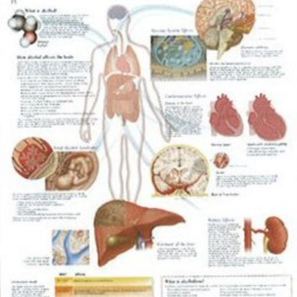 Effects of Alcohol Laminated Poster