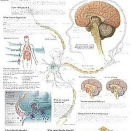 Understanding Depression Laminated Poster