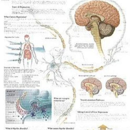 Understanding Depression Paper Poster