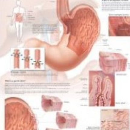 Understanding the Stomach Laminated Poster