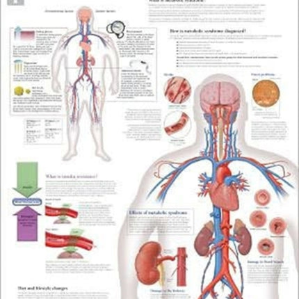 Understanding Metabolic Syndrome Paper Poster