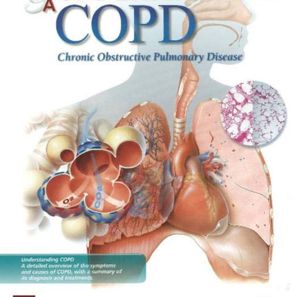 Understanding COPD Flip Chart