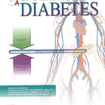 Understanding Diabetes Flip Chart