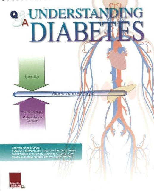 Understanding Diabetes Flip Chart