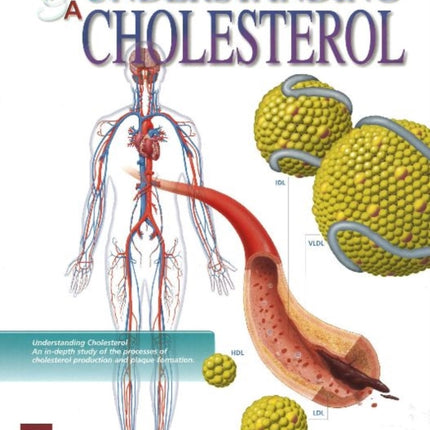 Understanding Cholesterol Flip Chart