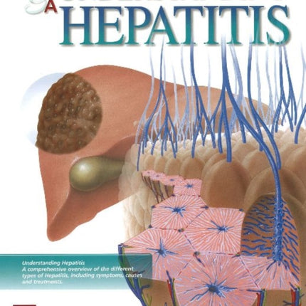 Understanding Hepatitis Flip Chart