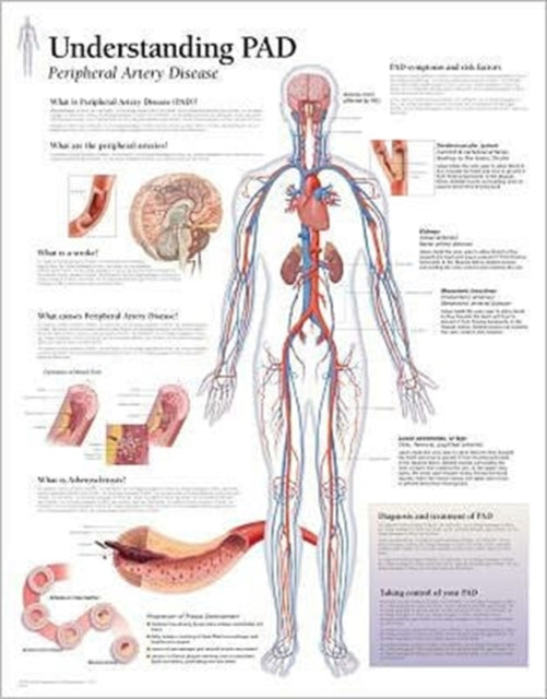 Understanding PAD Paper Poster