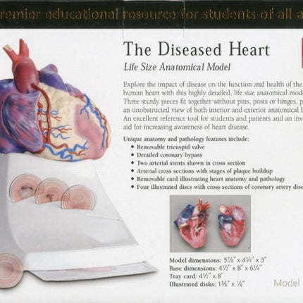 Life Size Diseased Heart Model