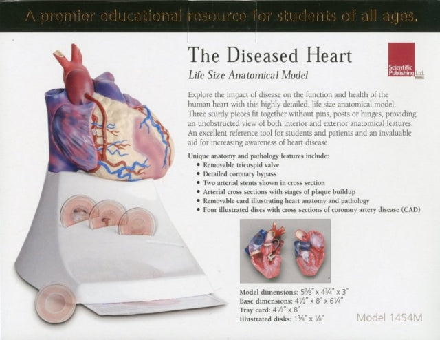 Life Size Diseased Heart Model