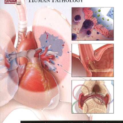 Illustrated Atlas of Human Pathology: A Collection of 25 Anatomical Charts of Human Pathology