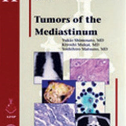 Tumors of the Mediastinum
