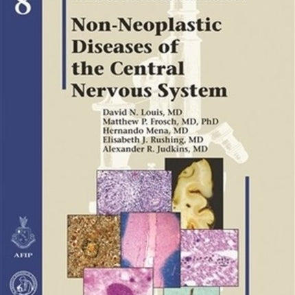 Non-Neoplastic Diseases of the Central Nervous System