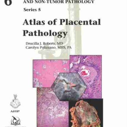 Atlas of Placental Pathology