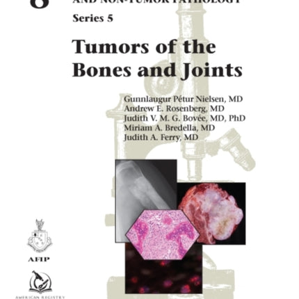 Tumors of the Bones and Joints