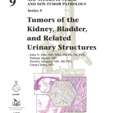 Tumors of the Kidney, Bladder, and Related Urinary Structures