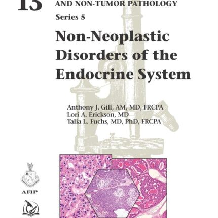 Non-Neoplastic Disorders of the Endocrine System