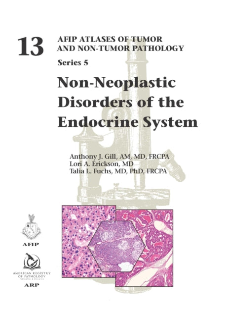 Non-Neoplastic Disorders of the Endocrine System