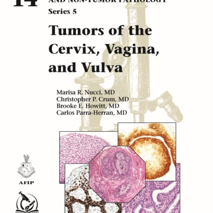 Tumors of the Cervix, Vagina, and Vulva