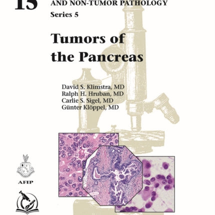 Tumors of the Pancreas
