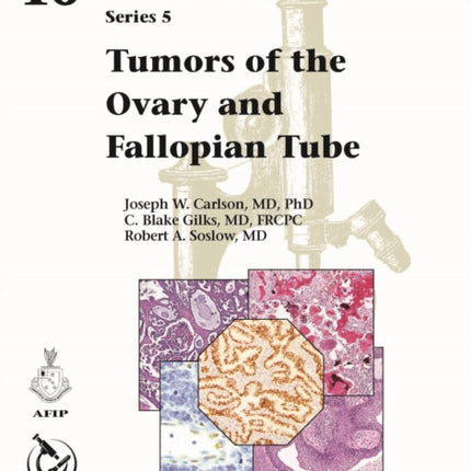 Tumors of the Ovary and Fallopian Tube