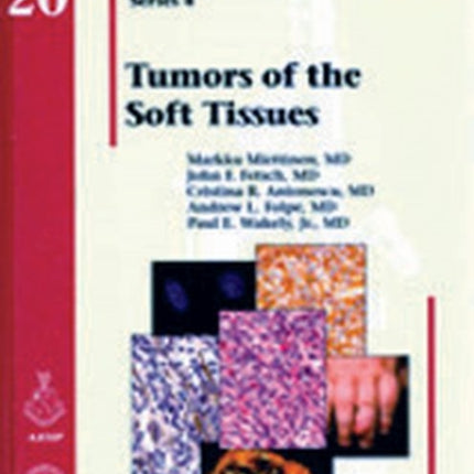 Tumors of the Soft Tissues